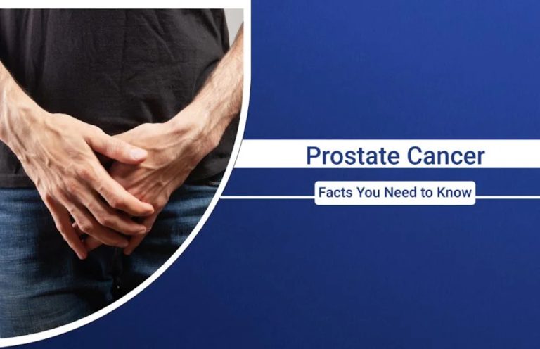 Prostate Health Matters: Exploring Causes and Care Strategies