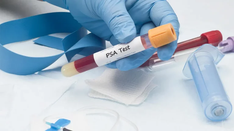 My Cancer Journal, Entry 1: Prostate Test “4” – ‘High Chance’