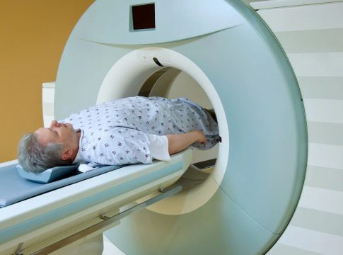 Navigating Prostate Cancer Diagnosis: The Role of PI-RADS